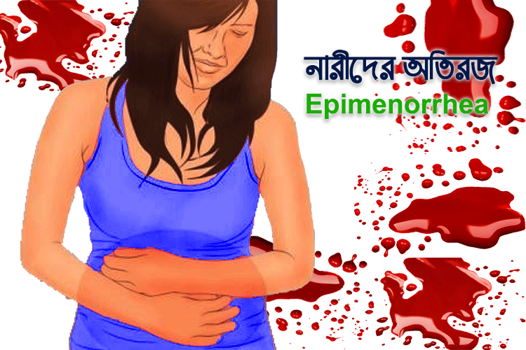 Epimenorrhea অতিরজ