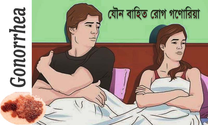 Gonorrhea homeopathic treatment গণোরিয়া