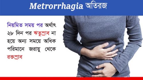 অতিরজ বা মেট্রোরেজিয়া (Metrorrhagia)