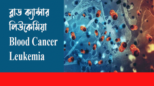 Blood Cancer Leukemia